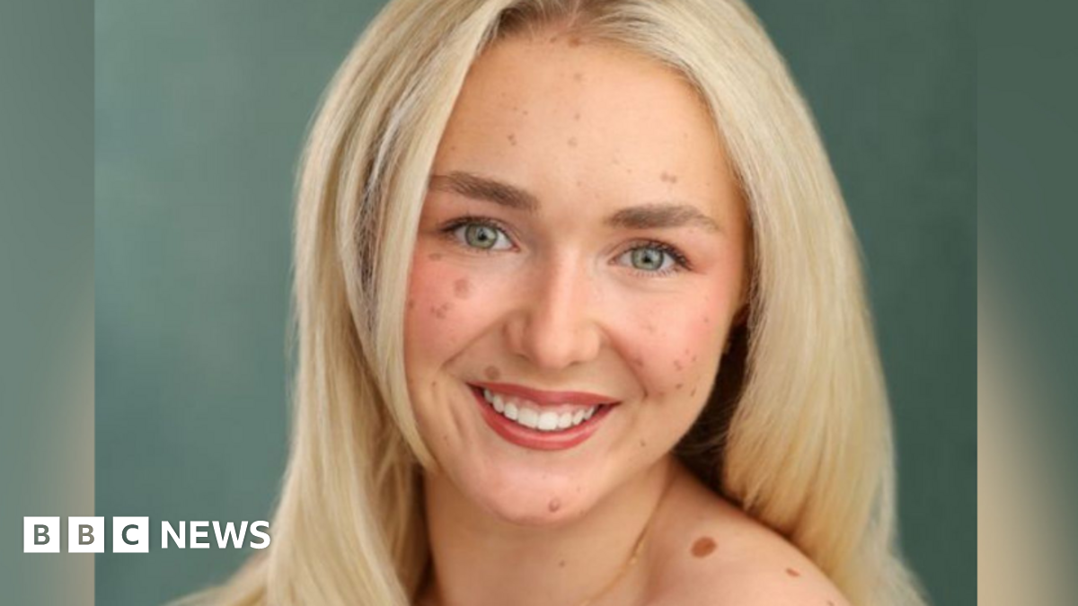 Helen Stroud is wearing a sports crop top showing her back, which has a slightly darker tone to it, showing the light scarring of surgeries. She has her blonde hair loosely tied back and is smiling as she turns her head to the right. She is standing in a garden with grass in the background and a fence.