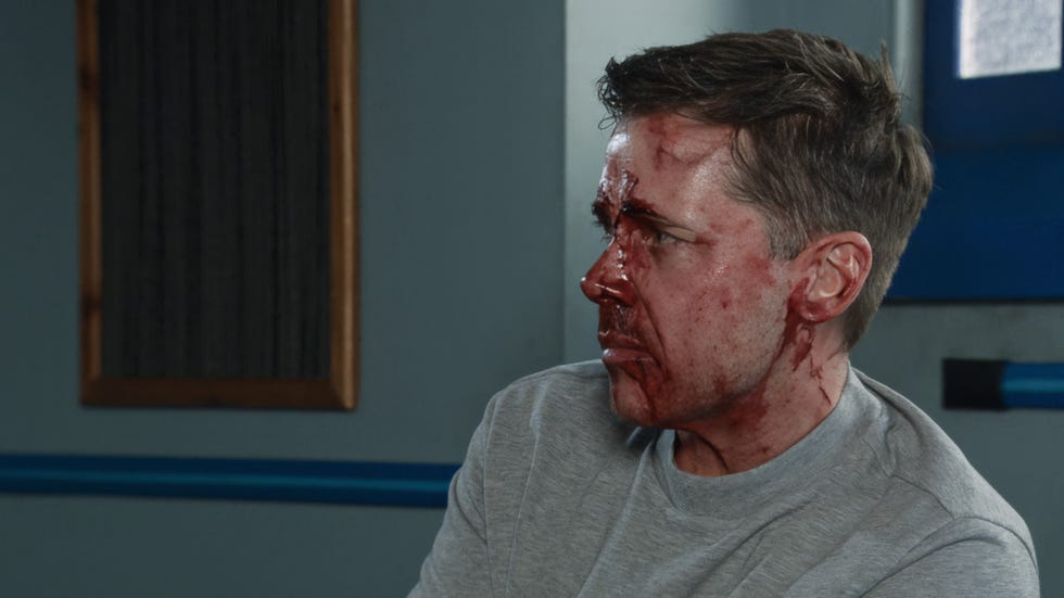 Todd Grimshaw, Coronation Street todd grimshaw, coronation street