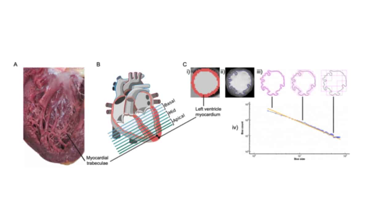 Figure Showing Exploration Of Human Heart Physiology