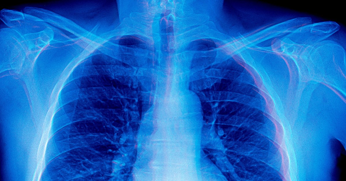 Frontier AI Models Are Doing Something Absolutely Bizarre When Asked to Diagnose Medical X-Rays