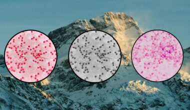 a picture of bacteria petri dishes on a mountain background to depict gut health at altitude