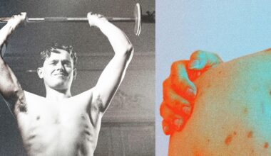 Does Working Out Help Psoriasis or Make It Worse?