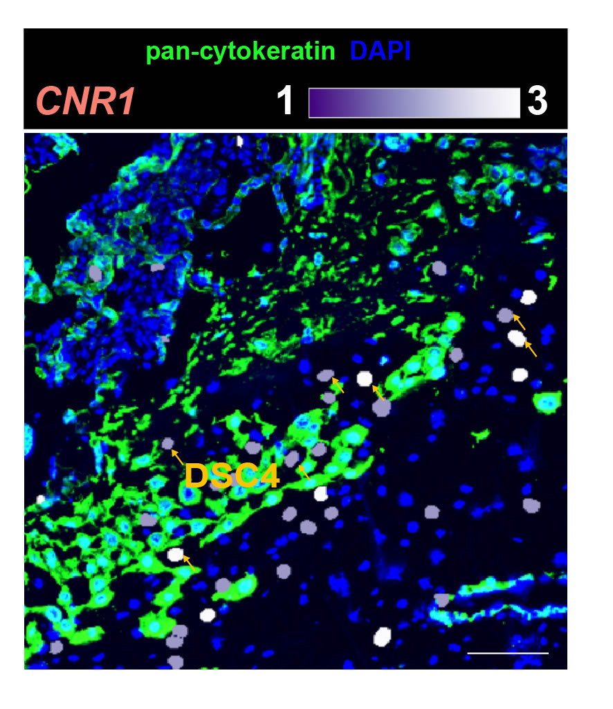 image depicting cells in a tissue labeled with blue, green and grey. A type of cell labeled "DSC4" is highlighted with small arrows