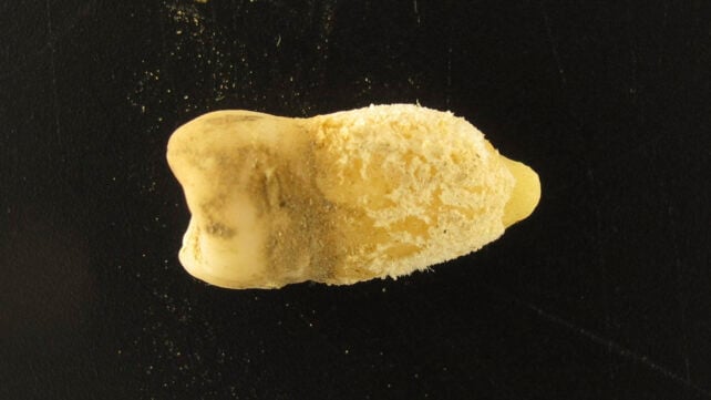 A Bolivian Mummy Tooth