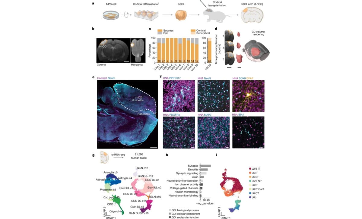 Transplantation Of Human Cortical Organoids In The Developing Rat Cortex