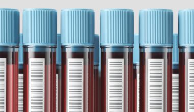 Oura and other wearables offer blood tests. Results may confuse patients : NPR