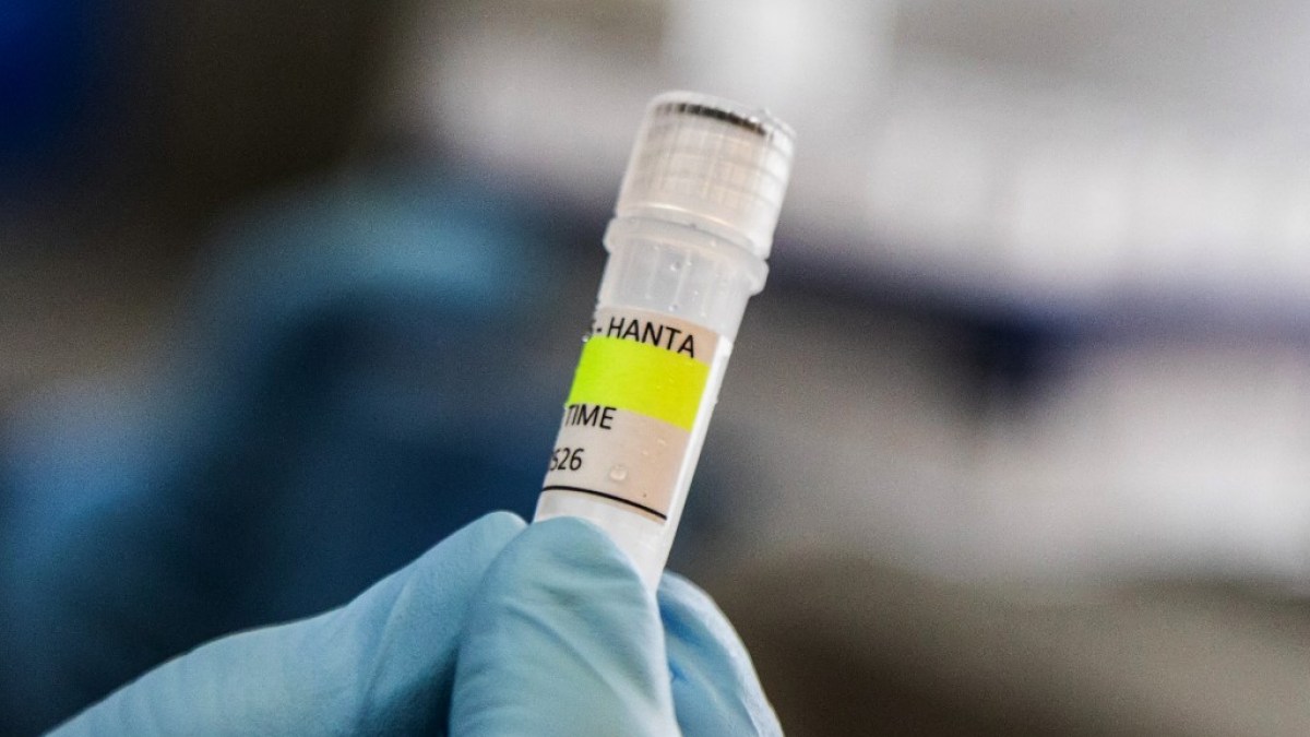 UK identifies new suspected hantavirus case on remote island | Health News