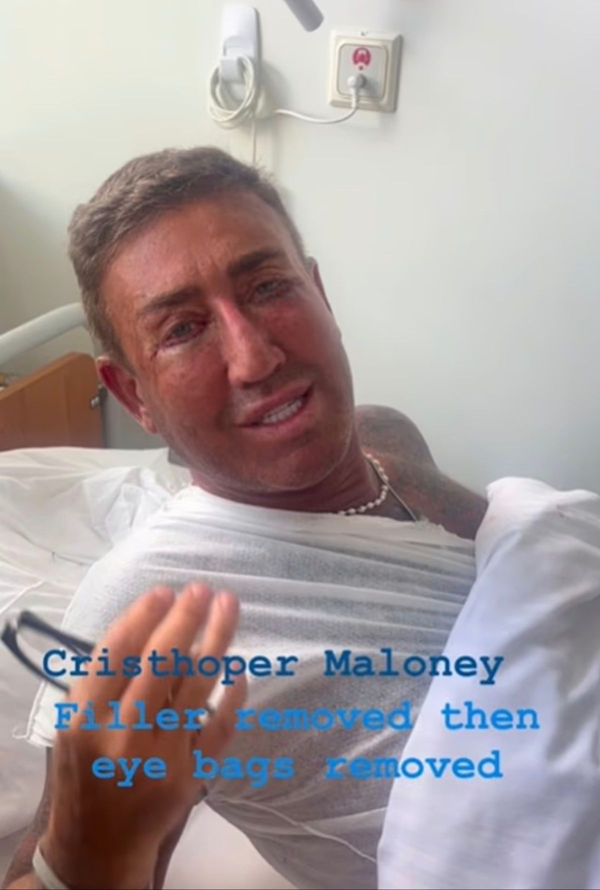 The star showed off the results of his most recent surgery
