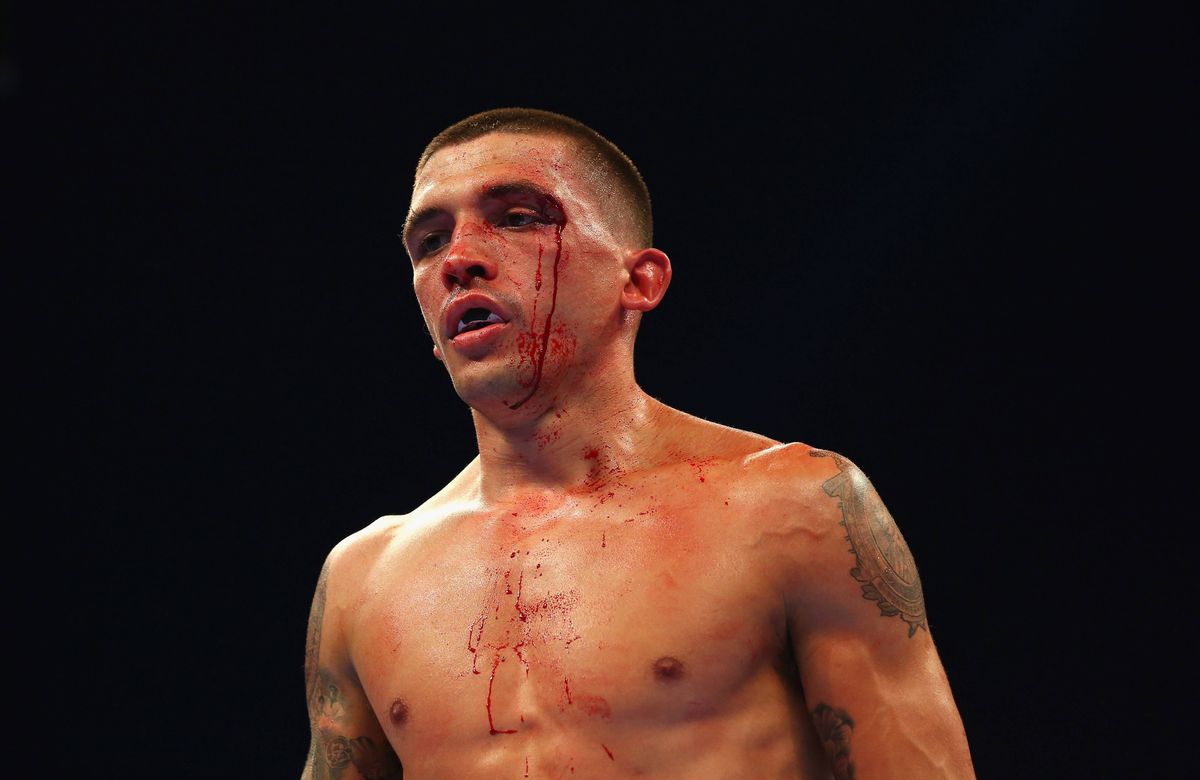 An image depicts an individual standing against a dark background, likely within a sports arena, showing visible signs of physical exertion. The person has tattoos covering a significant portion of their arms and torso. Blood is visible on the individual's face, indicating recent physical contact. The individual appears to be looking to the side, possibly focusing on an opponent or the audience.