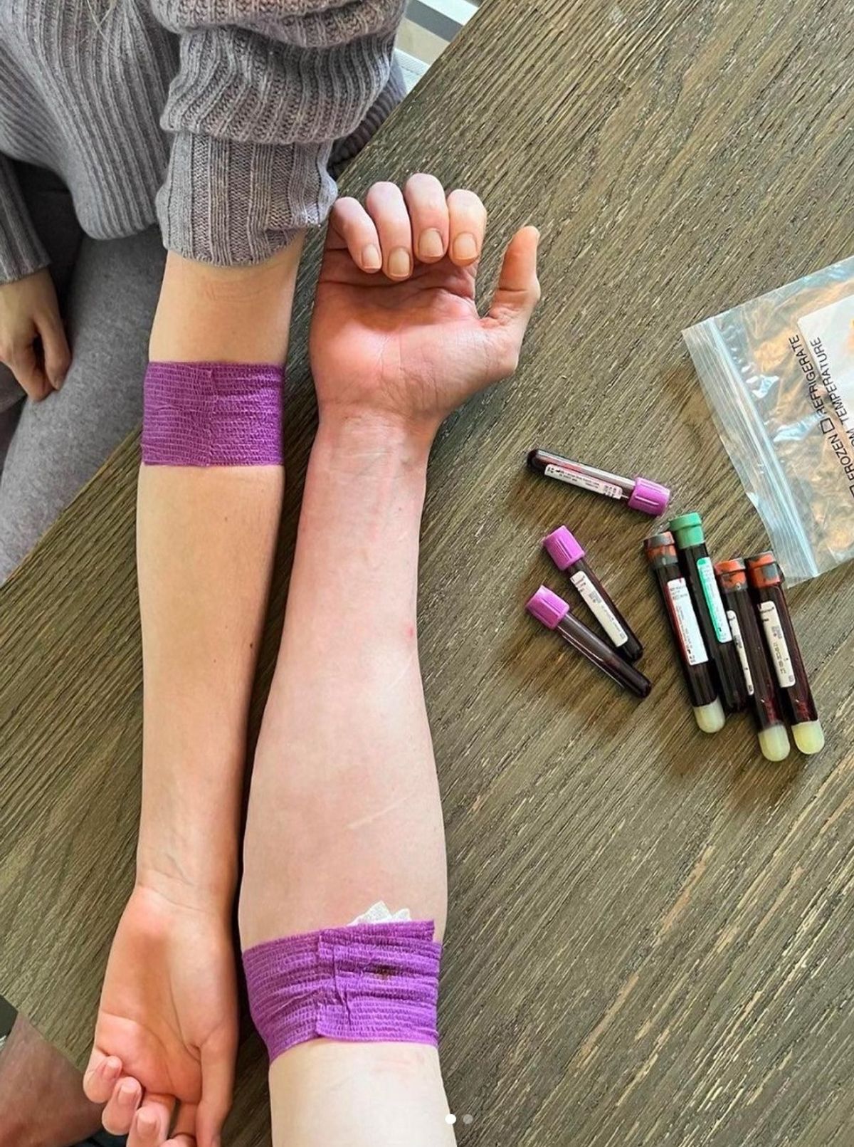 Johnson received plasma infusions
