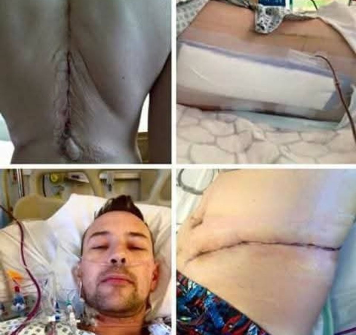 Simon in hospital following surgery