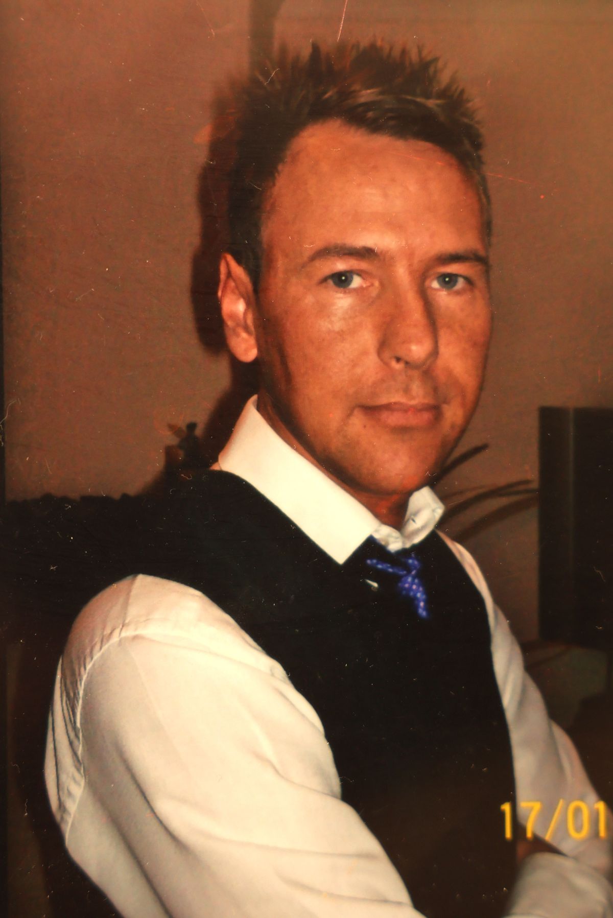 Simon Wainwright before his surgery