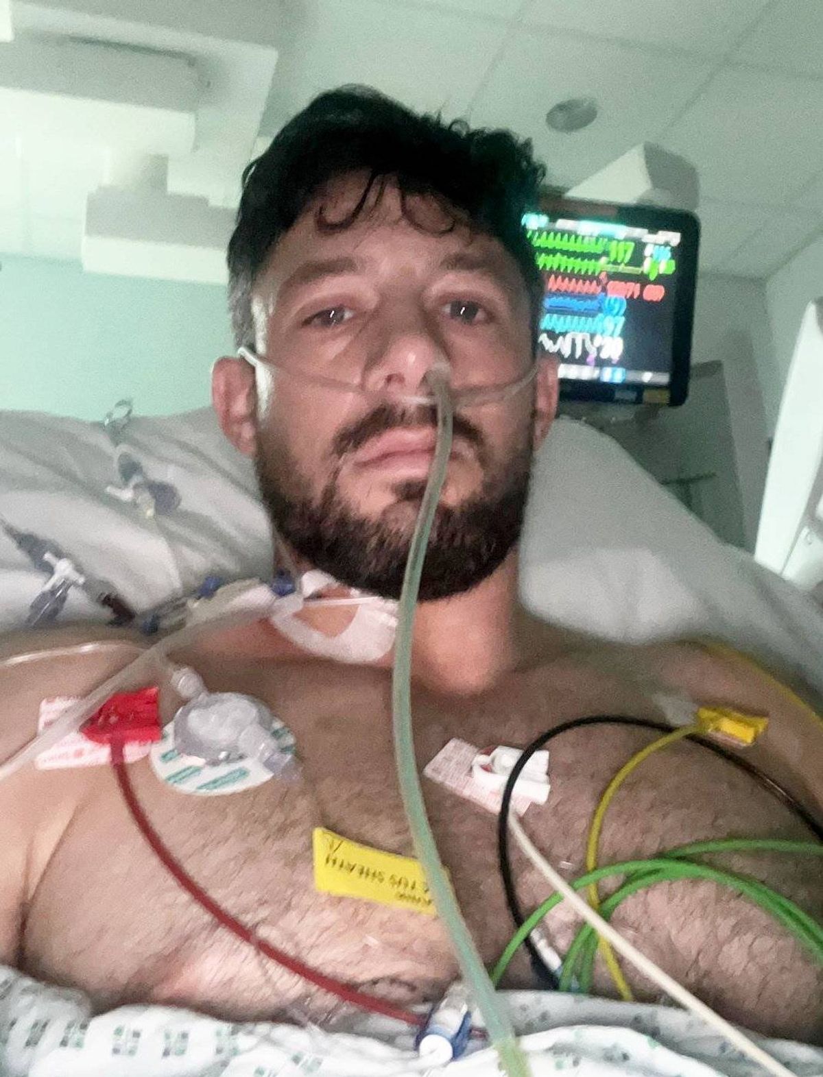 An individual with a beard and mustache, lying in a hospital bed, is seen wearing an oxygen tube and a medical mask. Behind him, a monitor displays vital signs. The setting is a hospital room, with a ceiling light providing illumination.
