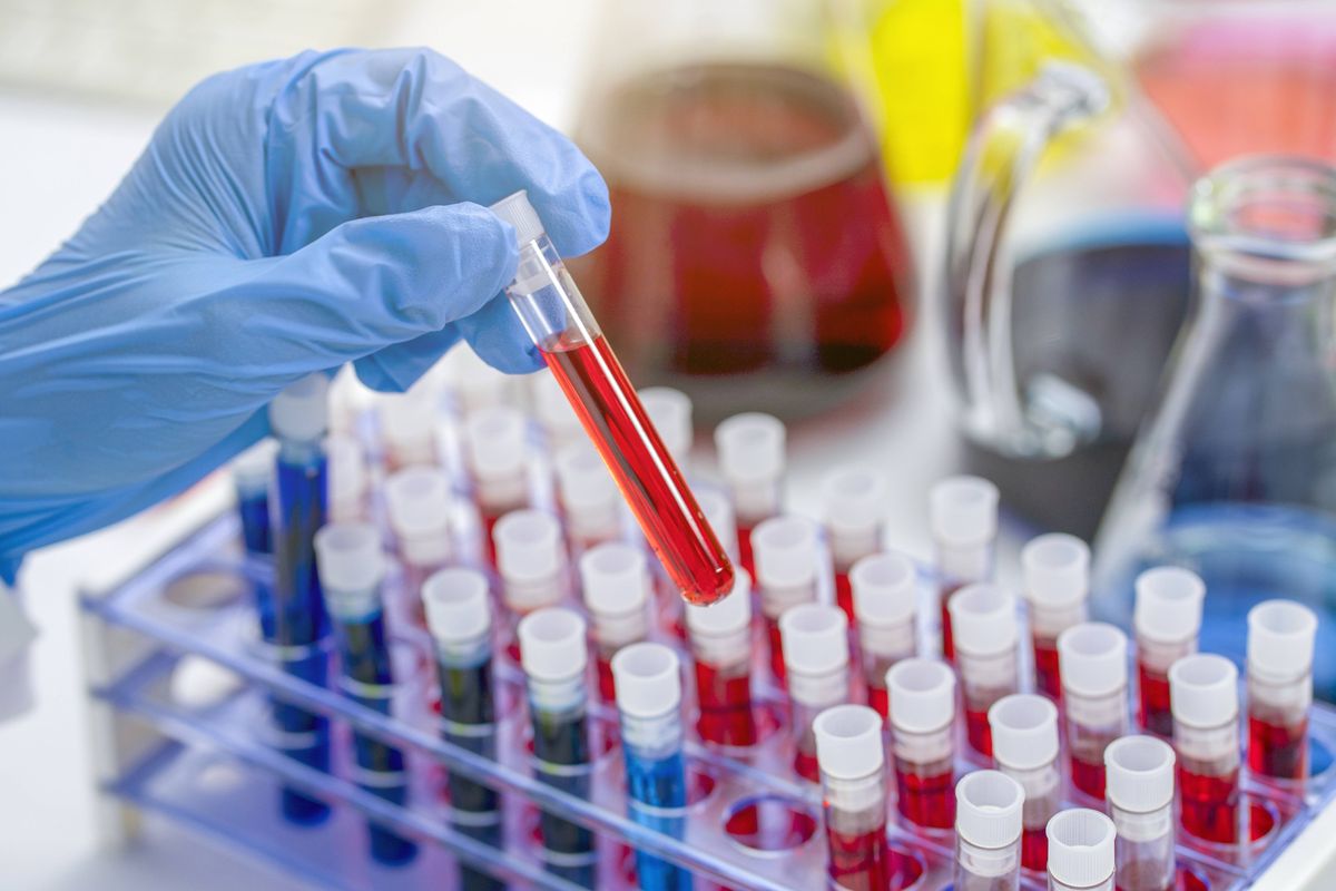 hands of a lab technician with a tube of blood sample and a rack with other samples.