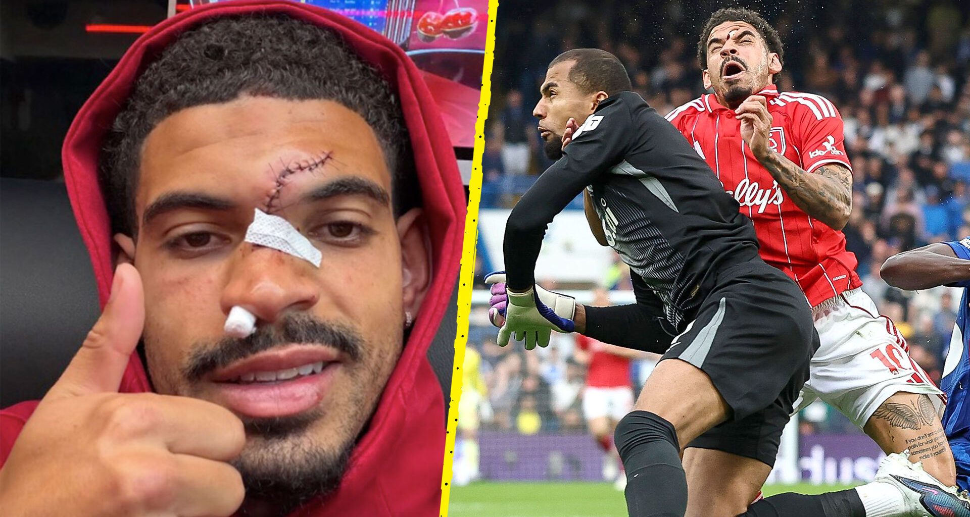 Morgan Gibbs-White shares gruesome results of injury to face as star requires stitches after collision