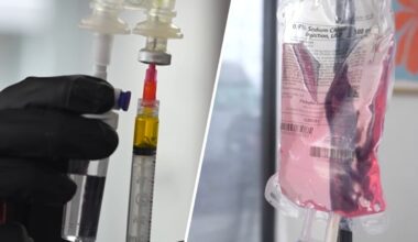 IV therapy, explained: it’s not just for hangovers anymore – NBC Boston