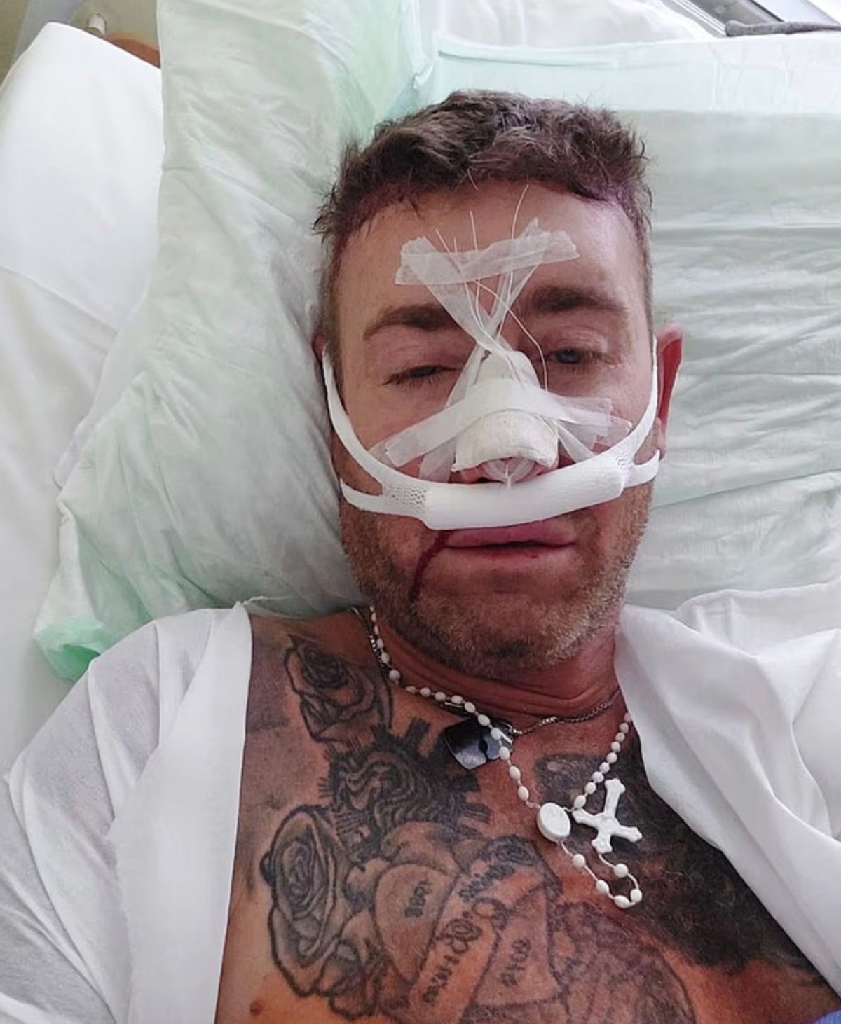 Chris has been open about his 'addiction' to surgery