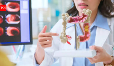 Colon cancer in young: 4 early warning signs you should not ignore, according to a Harvard doctor
