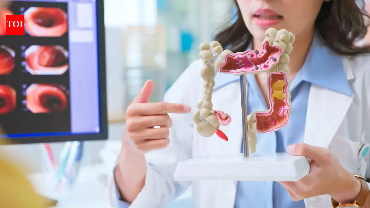 Colon cancer in young: 4 early warning signs you should not ignore, according to a Harvard doctor
