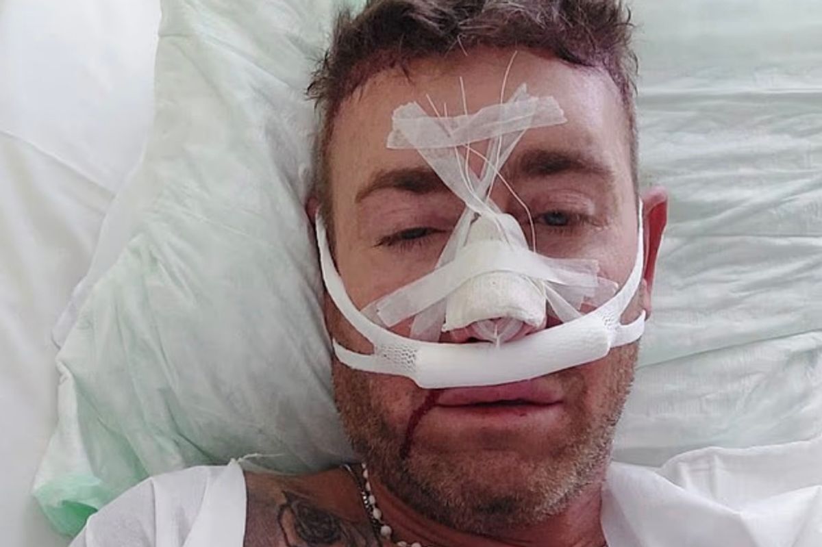 Christopher Maloney looks unrecognisable after more surgery