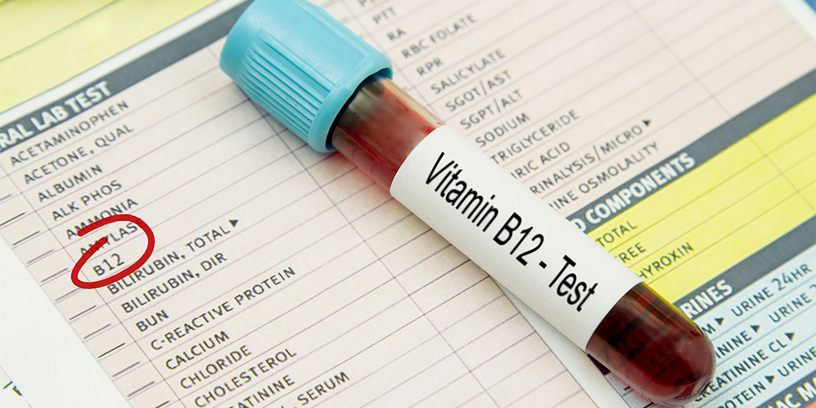 A phial of blood with vitamin B12 test written on it.