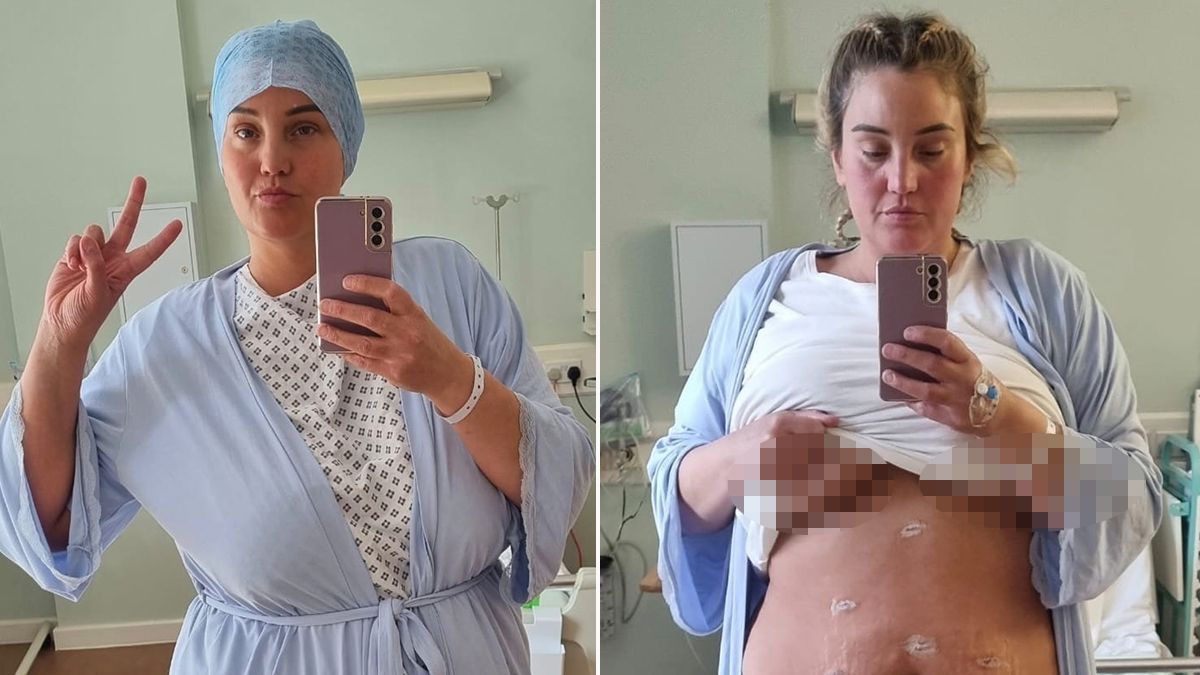 Pamela before undergoing bariatric surgery