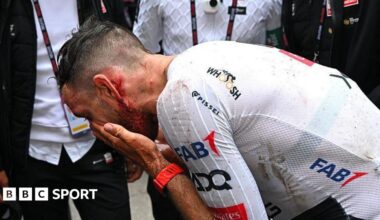 Adam Yates assess his injuries following a crash during stage 2 of the Giro d'Italia