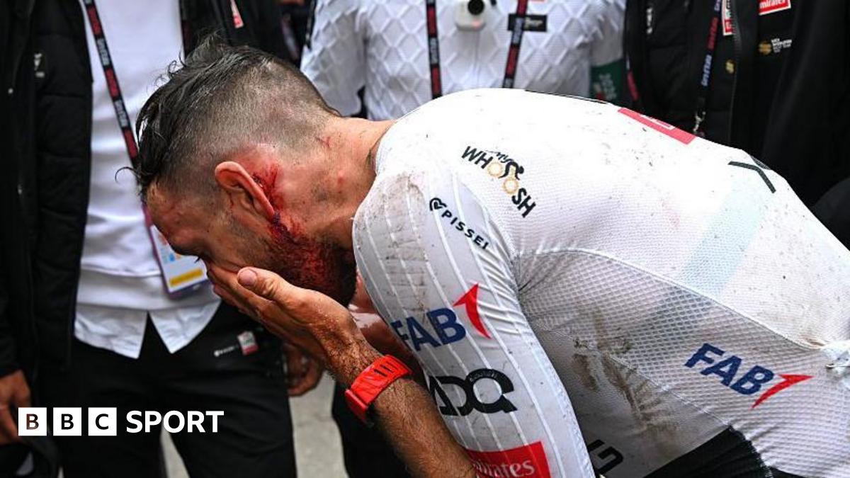Adam Yates assess his injuries following a crash during stage 2 of the Giro d'Italia