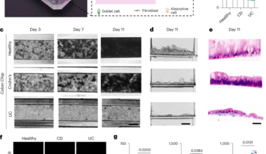 Human inflammatory bowel disease-on-a-chip for modelling disease progression, cancer initiation and sex-specific effects