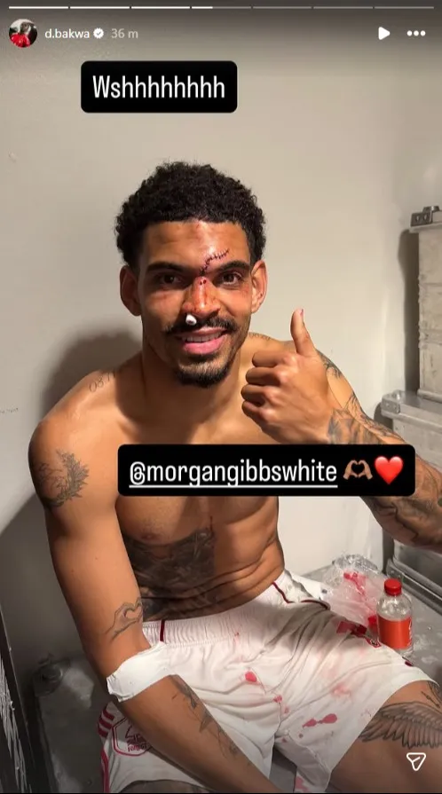 Morgan Gibbs-White shows off stitches on face after injury sustained at Chelsea