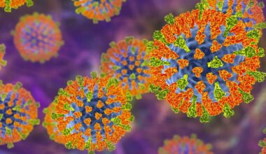 Victorian disease rips through the UK – 542 new cases reported