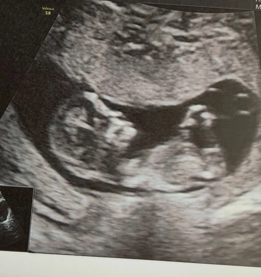 Laura Woods and Adam Collard announce they are expecting a second child