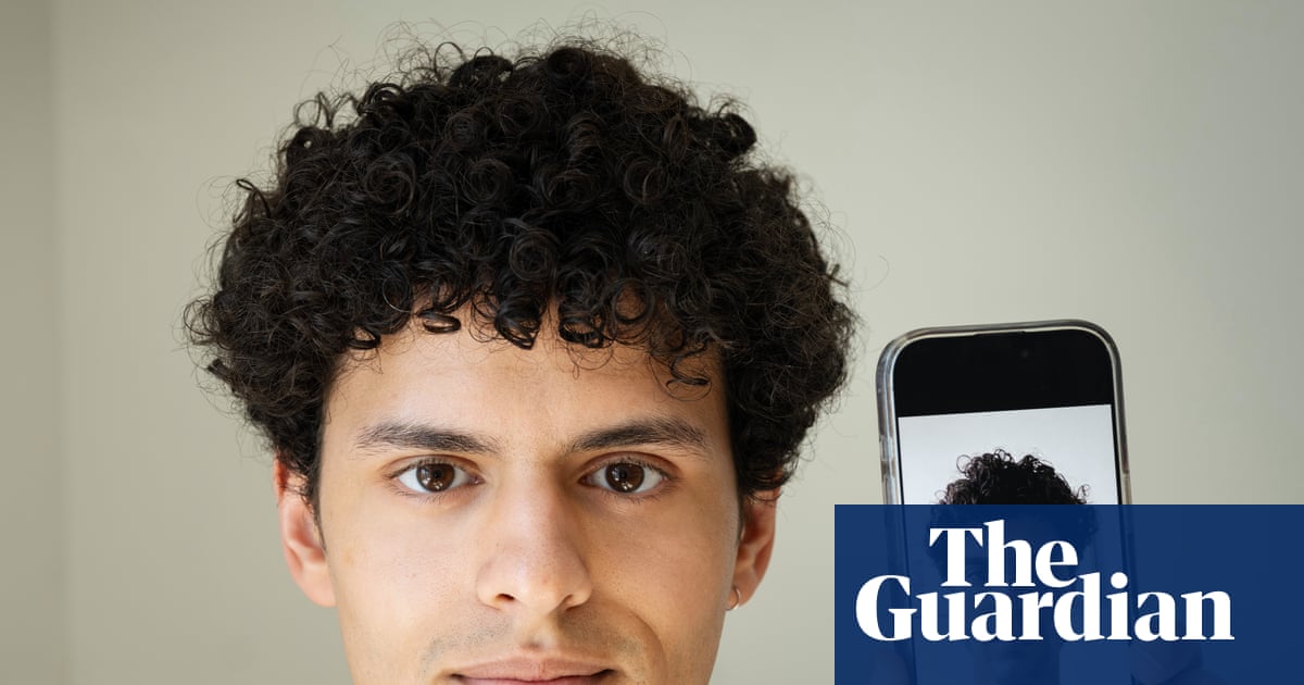 ‘You can’t control everything’: the rise in plastic surgeons asked to create ‘AI face’ | AI (artificial intelligence)