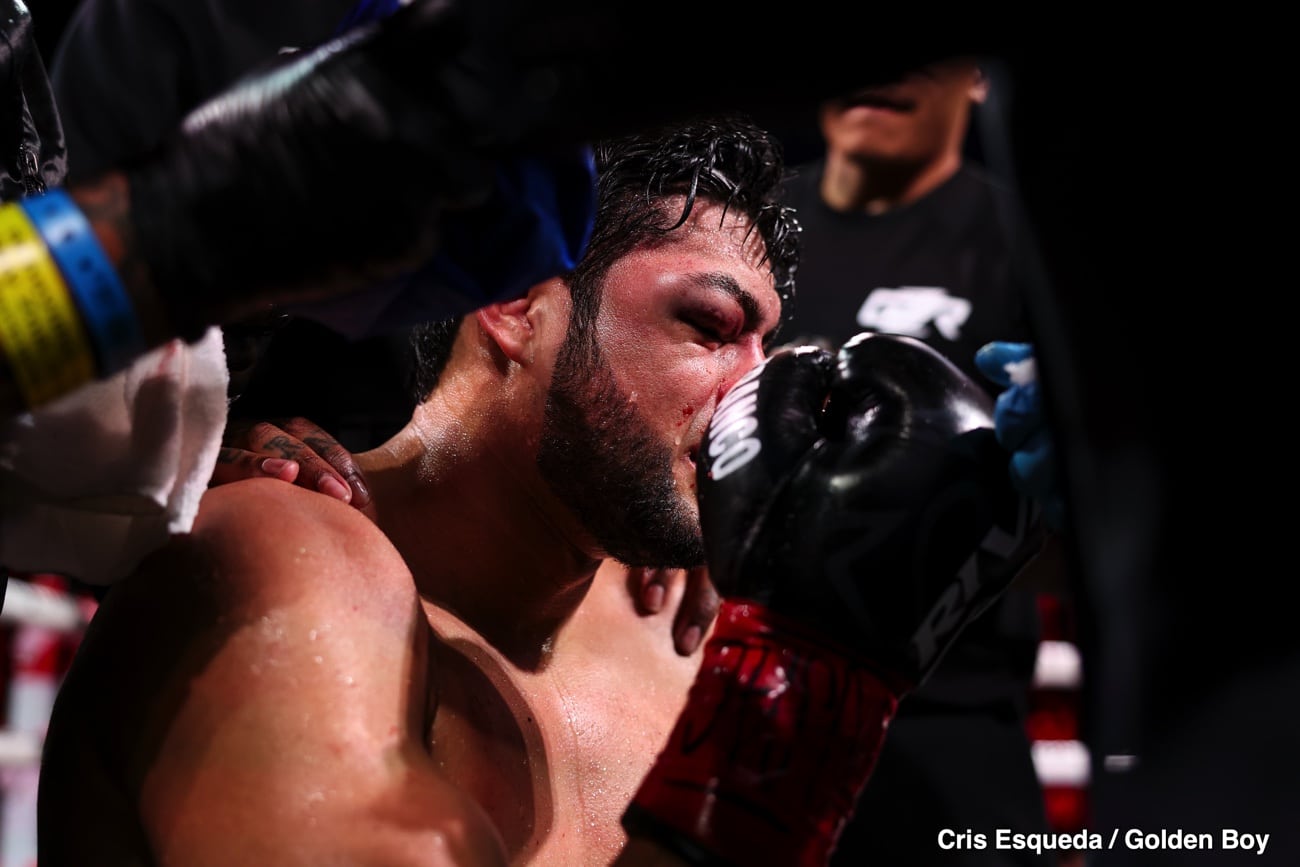 Zurdo Ramirez discharged, eye swelling improving after KO