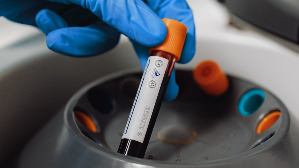 'Forever Chemicals' Found in 98.8% of Human Blood Samples Tested : ScienceAlert