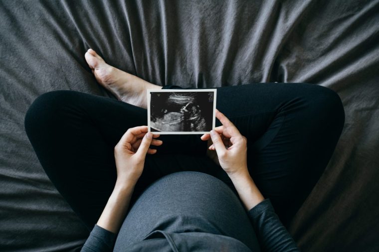 High angle shot of Asian pregnant woman holding an ultrasound scan photo in front of her baby bump, sitting on bed at home. Mother-to-be. Precious moment in life. Preparation for a new family member. Expecting a new life. Baby and new life concept - stock photo