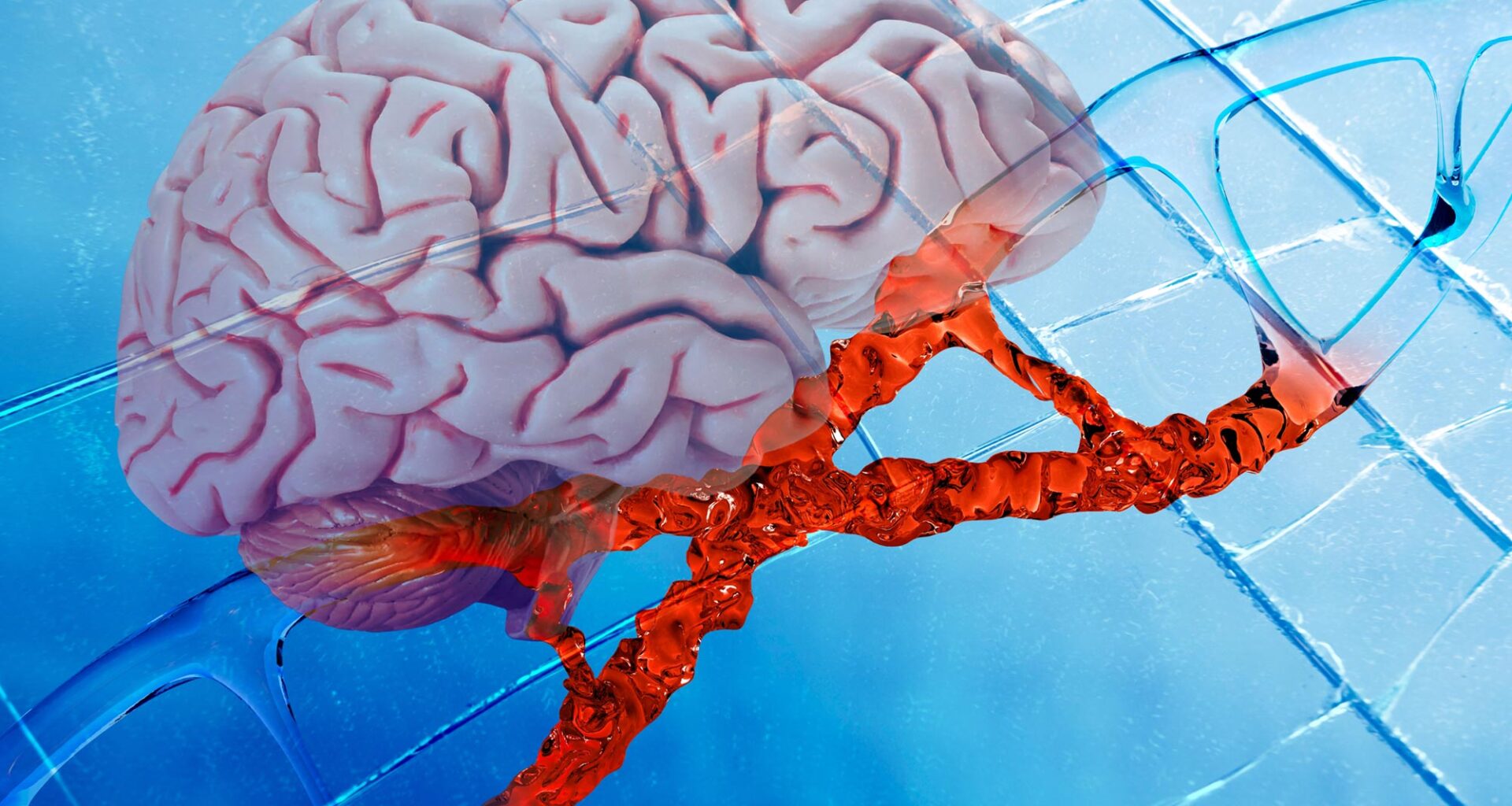 Human Brain DNA Mutation Neuroscience Genetics
