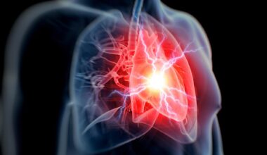 Human Heart Attack