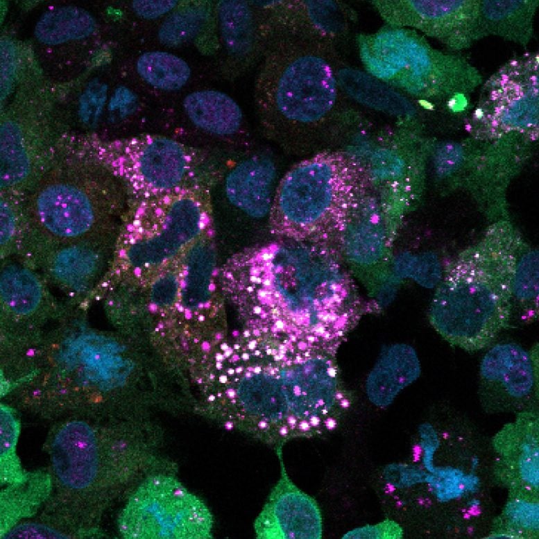Human Liver Cells Treated With a Drug That Induces Glycogen Ubiquitination