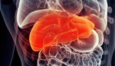 Human Liver.Pain Disease