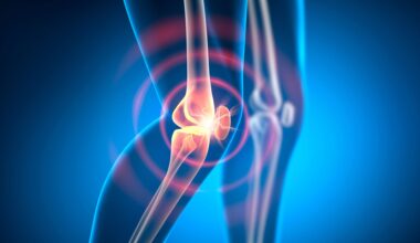 Knee Joint Pain Arthritis