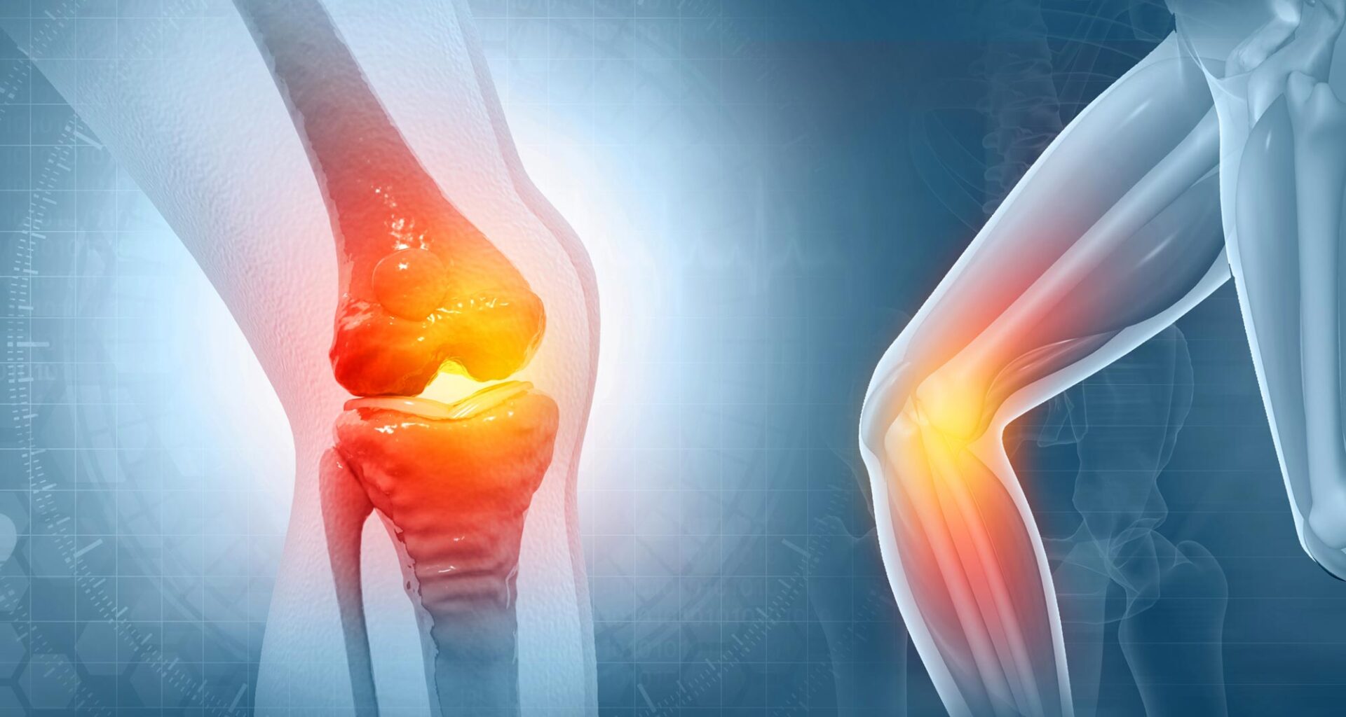 Knee Joint Pain Tendon Inflammation
