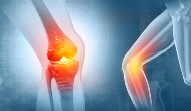 Knee Joint Pain Tendon Inflammation