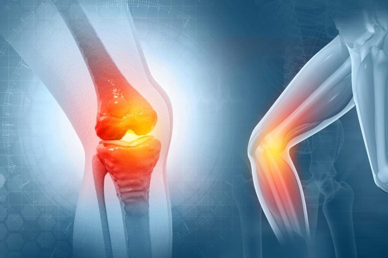 Knee Joint Pain Tendon Inflammation