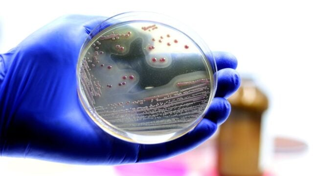 A gloved hand holding a petri dish 