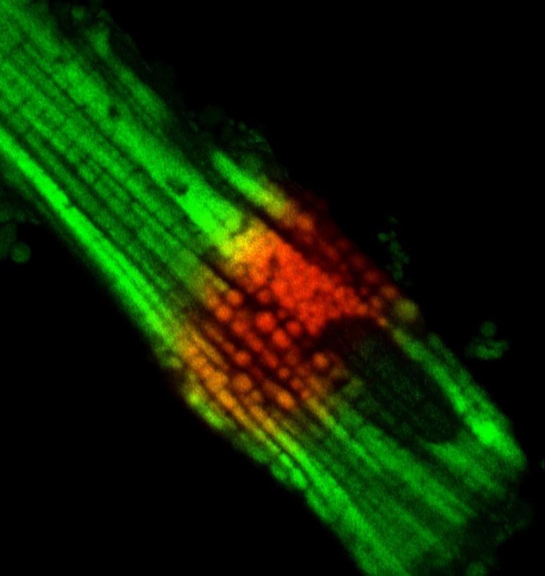 Mitochondria Heart Cell