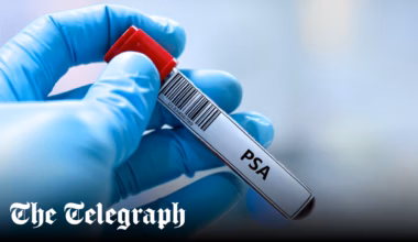 Advice to restrict prostate screening ‘lacks humanity’, say MPs