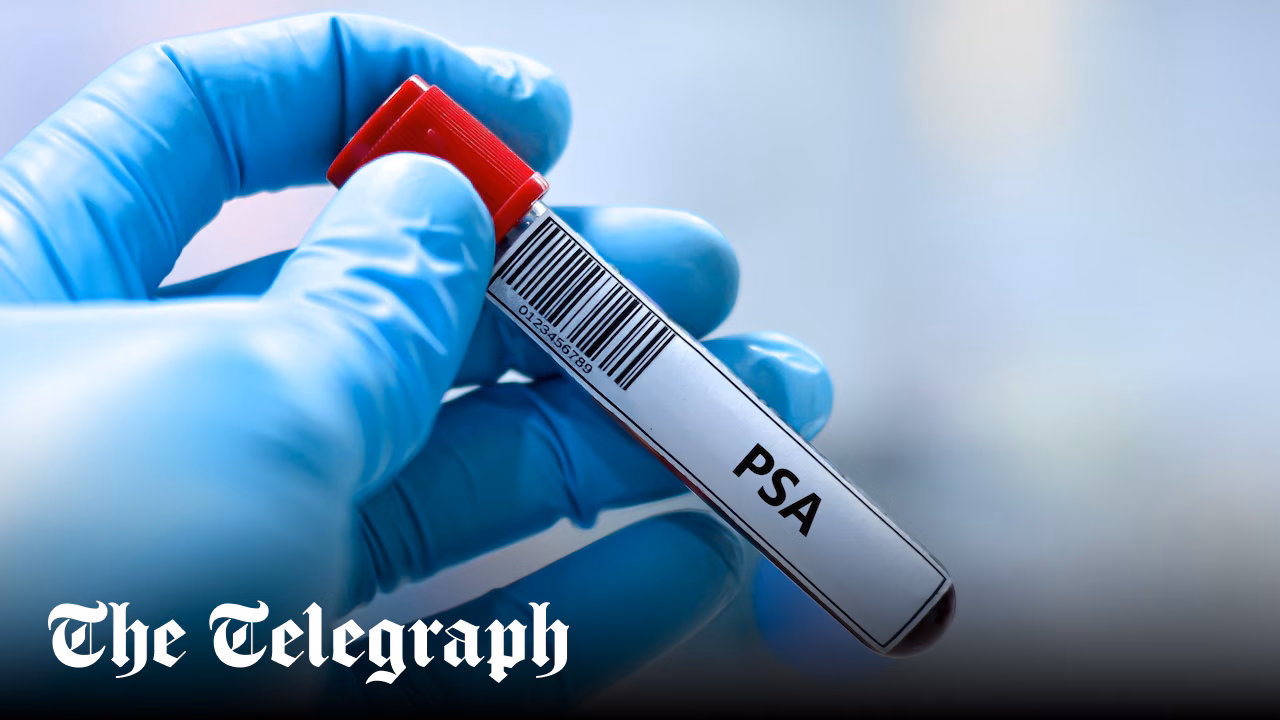 Advice to restrict prostate screening ‘lacks humanity’, say MPs