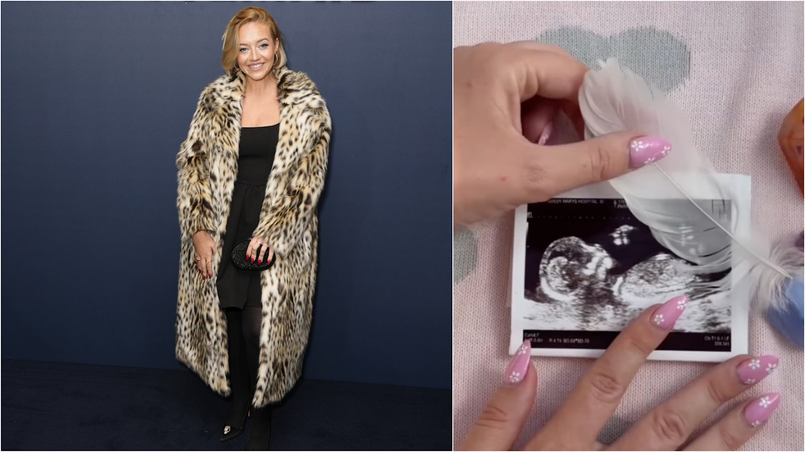 Tom Parker’s widow Kelsey Parker reveals she is pregnant with ‘rainbow baby’ after stillbirth