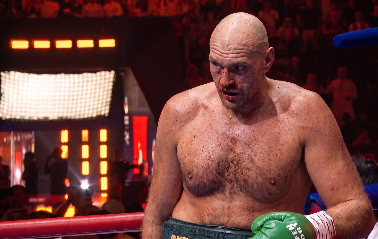 Image: Eddie Hearn: One Loss Ends Joshua-Fury Plans